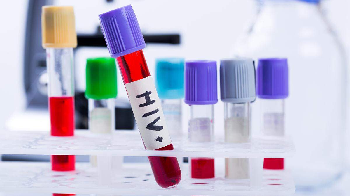 tubes with hiv test blood samples in laboratory