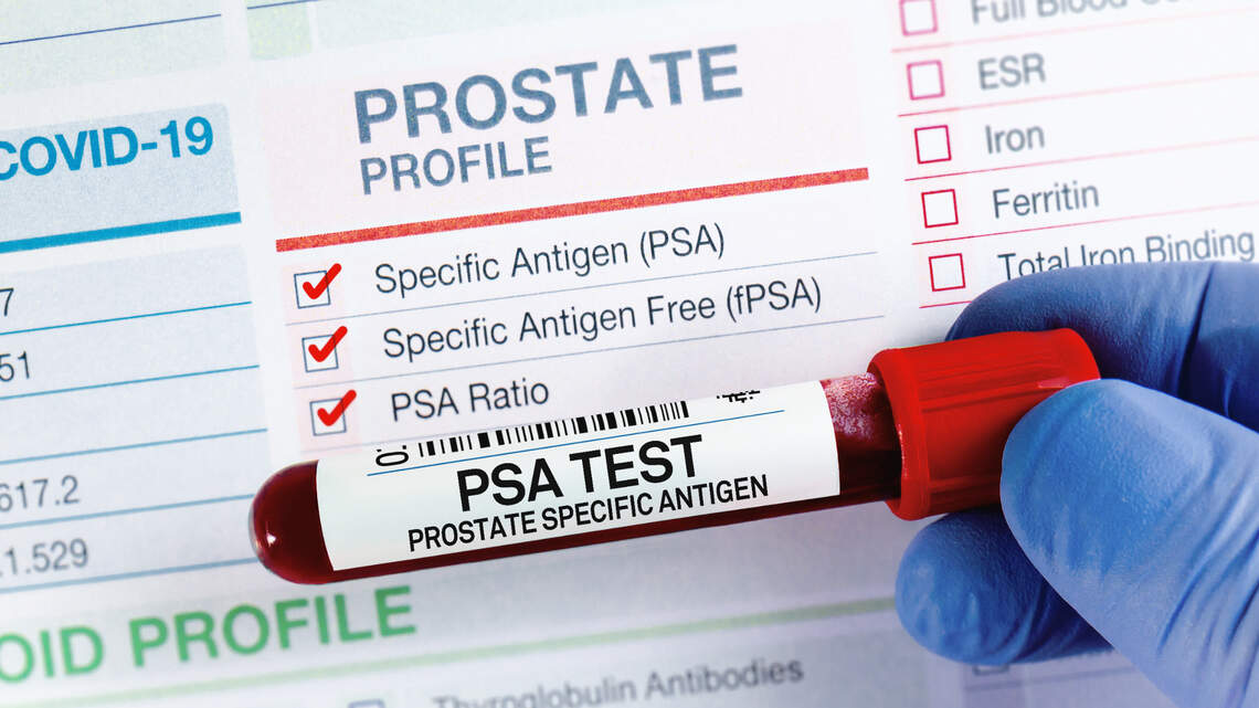 Genetic prostate cancer risks identified for men of African descent