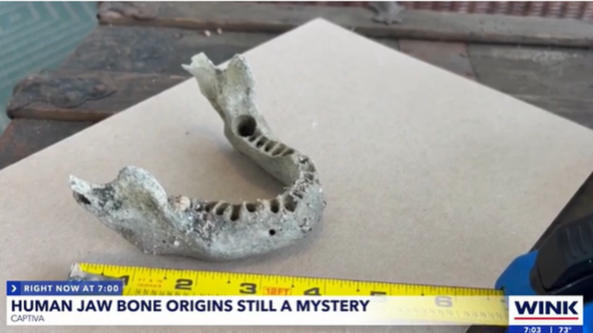 The jawbone was found Feb. 14 on Captiva Island and is currently being studied by a medical examiner, according to the Lee County Sheriff’s Office.