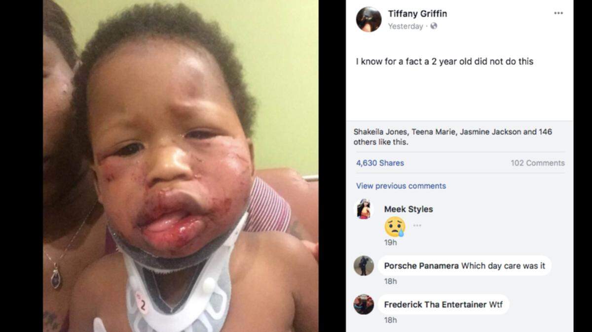 Prosecutors say no criminal charges will be filed in the beating of a 1-year-old boy at a day care last week.