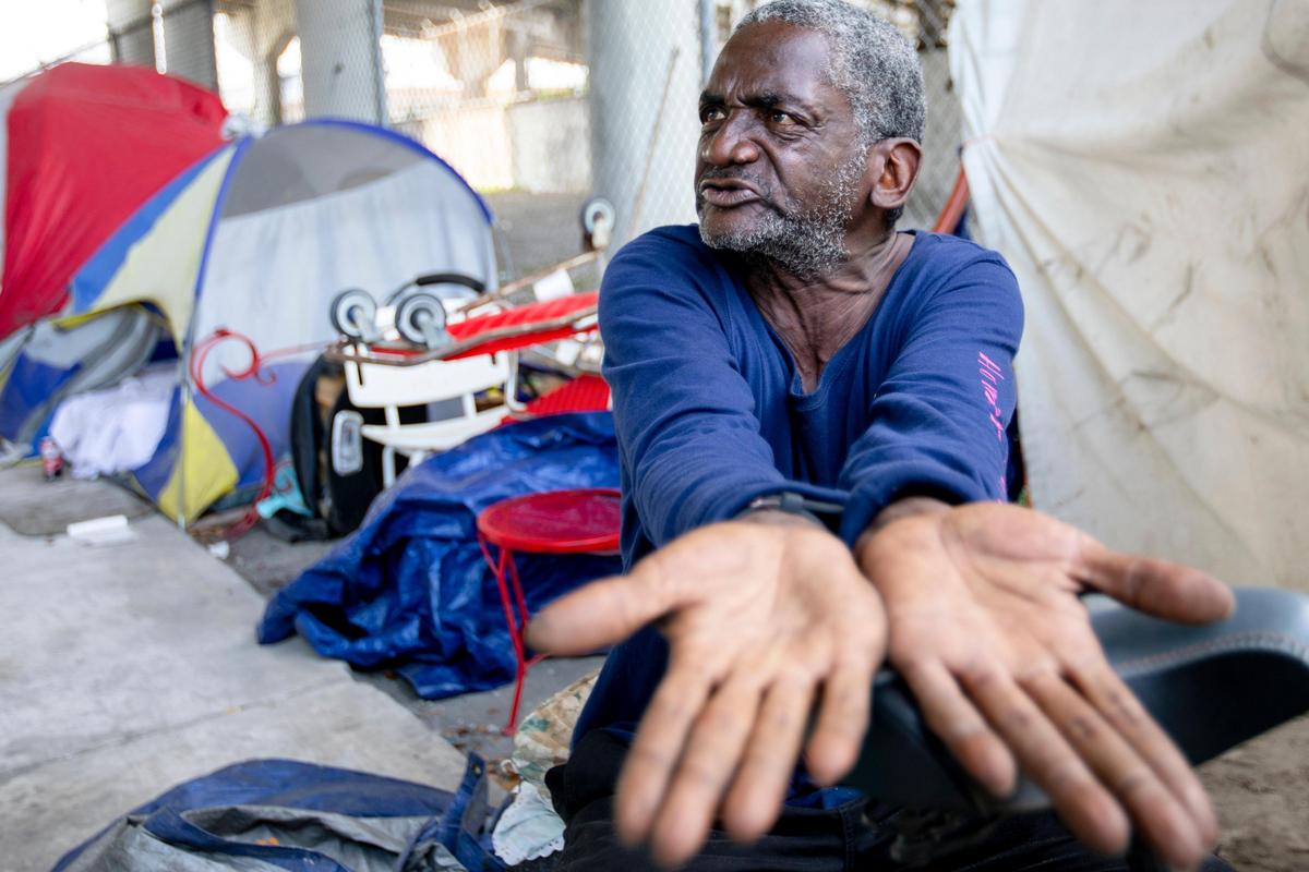 Jospeh Simmons shows his hands as he laments about the lack of sanitation and poor living conditions for the homeless in Overtown, Florida on Friday, April 24, 2020.