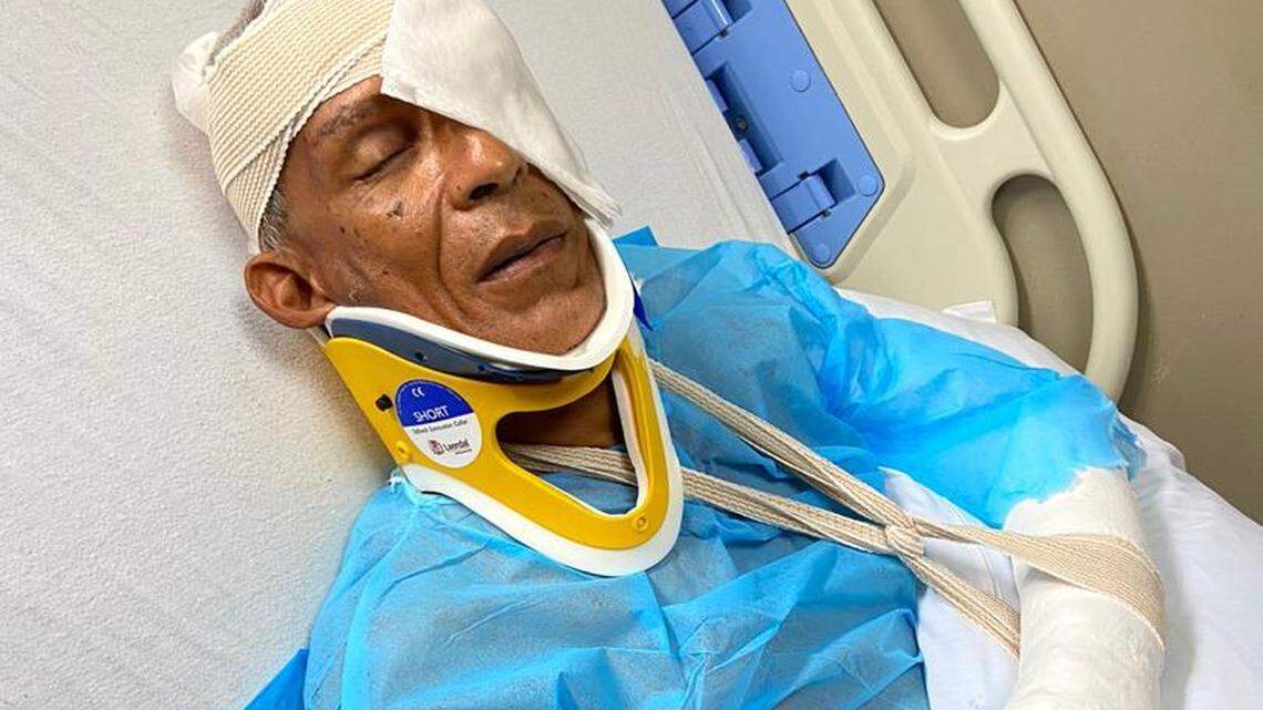 On May 5, a gang led by a justice of the peace in Haiti invaded Patrick Benoît’s 48 acres in the mostly residential Vivy Mitchell suburb of Port-au-Prince, savagely beat him, tied his hands and feet behind him with a rope like a crab, then refused to take him to a hospital for medical attention.