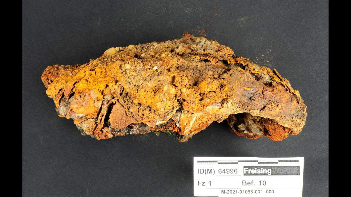 The prosthetic included an index finger, middle finger, ring finger and little finger, according to experts.