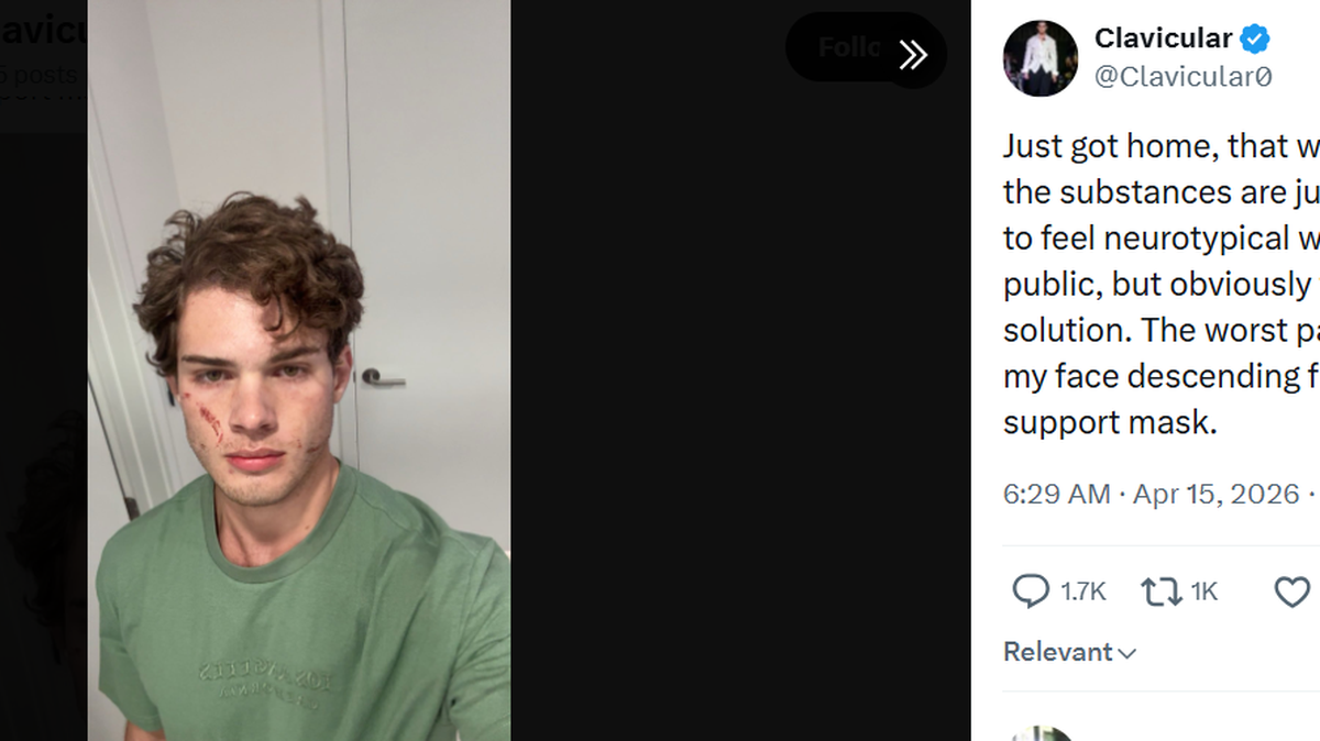 Online streamer and “looksmaxxer” Clavicular, aka Braden Peters
