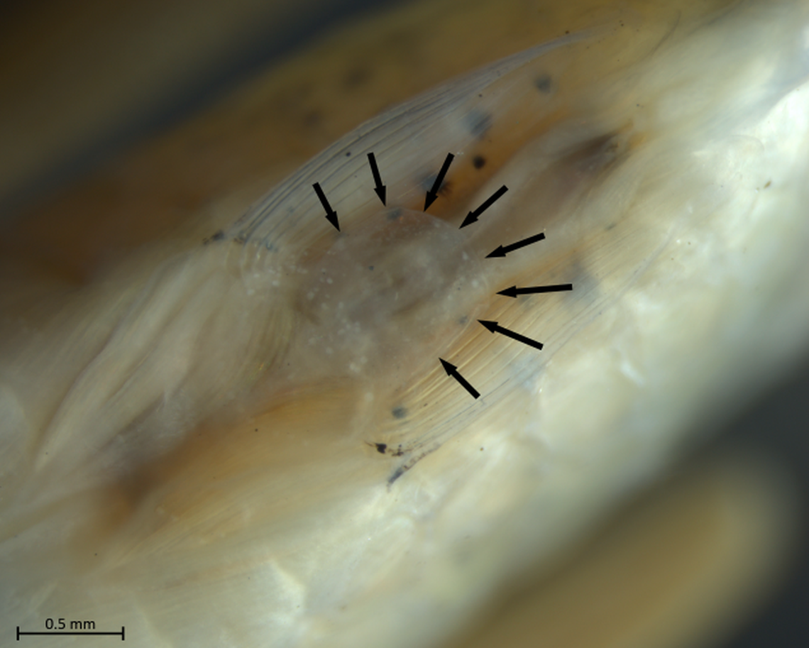 The flap covers the tube used to release sperm or eggs, researchers said.