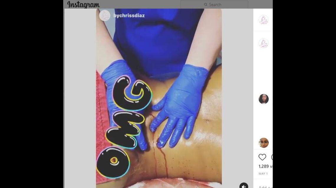 A still from a video on Miramar masseuse Cristina Diaz’s Instagram account shows blood flowing out of a client’s surgical incision during a lymphatic drainage massage. The state of Florida says Diaz isn’t licensed to perform these massages and does so in an unsanitary manner. This video was removed after this story posted.