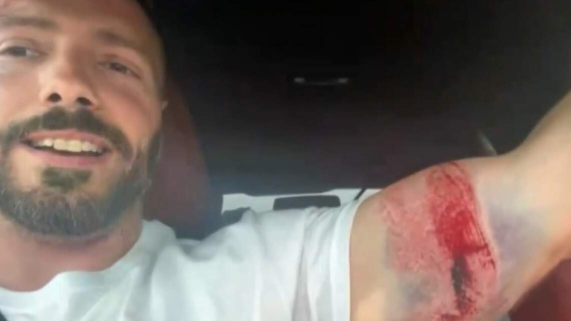 Miami Beach man trampled at Spain’s Running of the Bulls says he’ll return