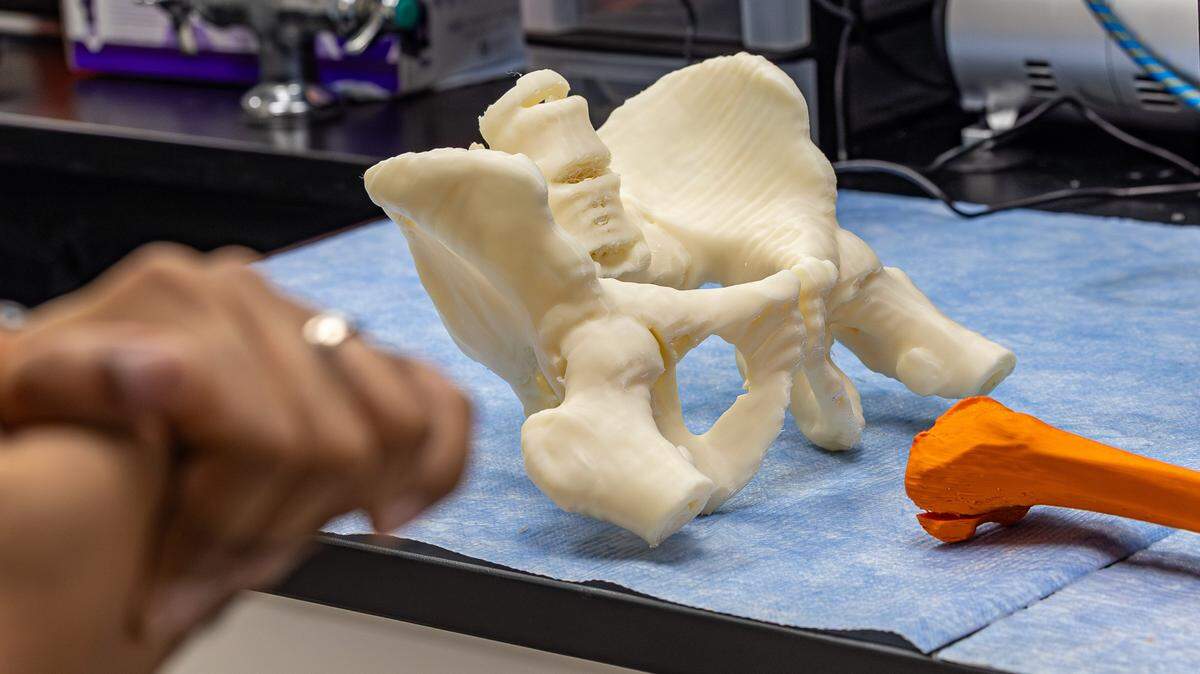 A 3D-printed pelvis serves as a reference model for pre-operative planning, patient education and surgical training at the 3D Bioprinting Facility at the University of Miami Miller School of Medicine in Miami on Tuesday, June 2, 2026.