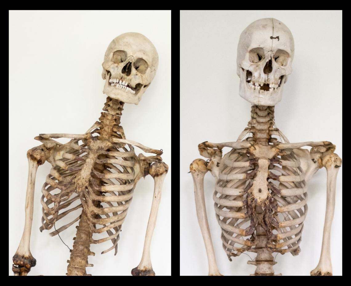 The remains of Schinderhannes, now identified on the left, were previously thought to belong to Black Jonas. The second set of remains are now a mystery.