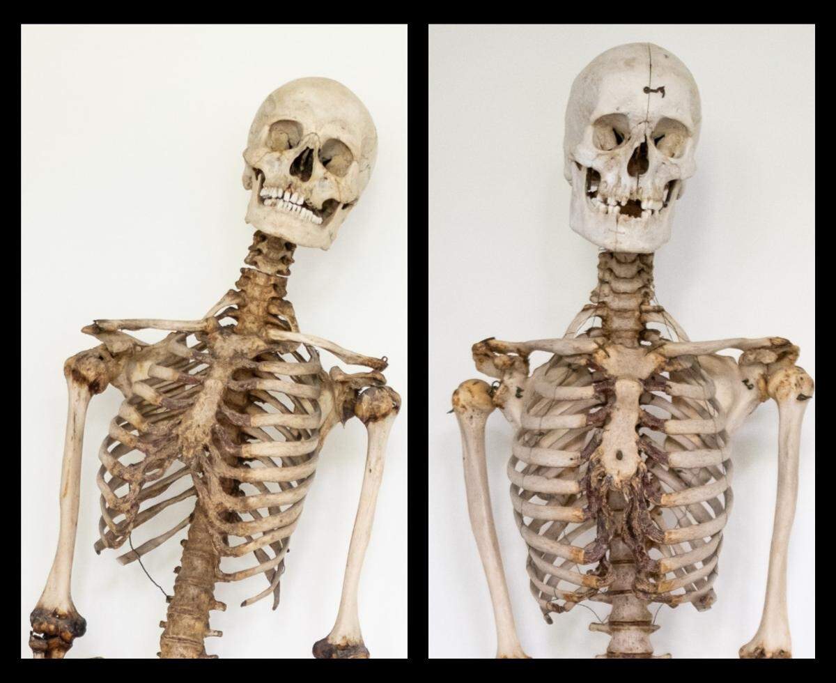 The remains of Schinderhannes, now identified on the left, were previously thought to belong to Black Jonas. The second set of remains are now a mystery.