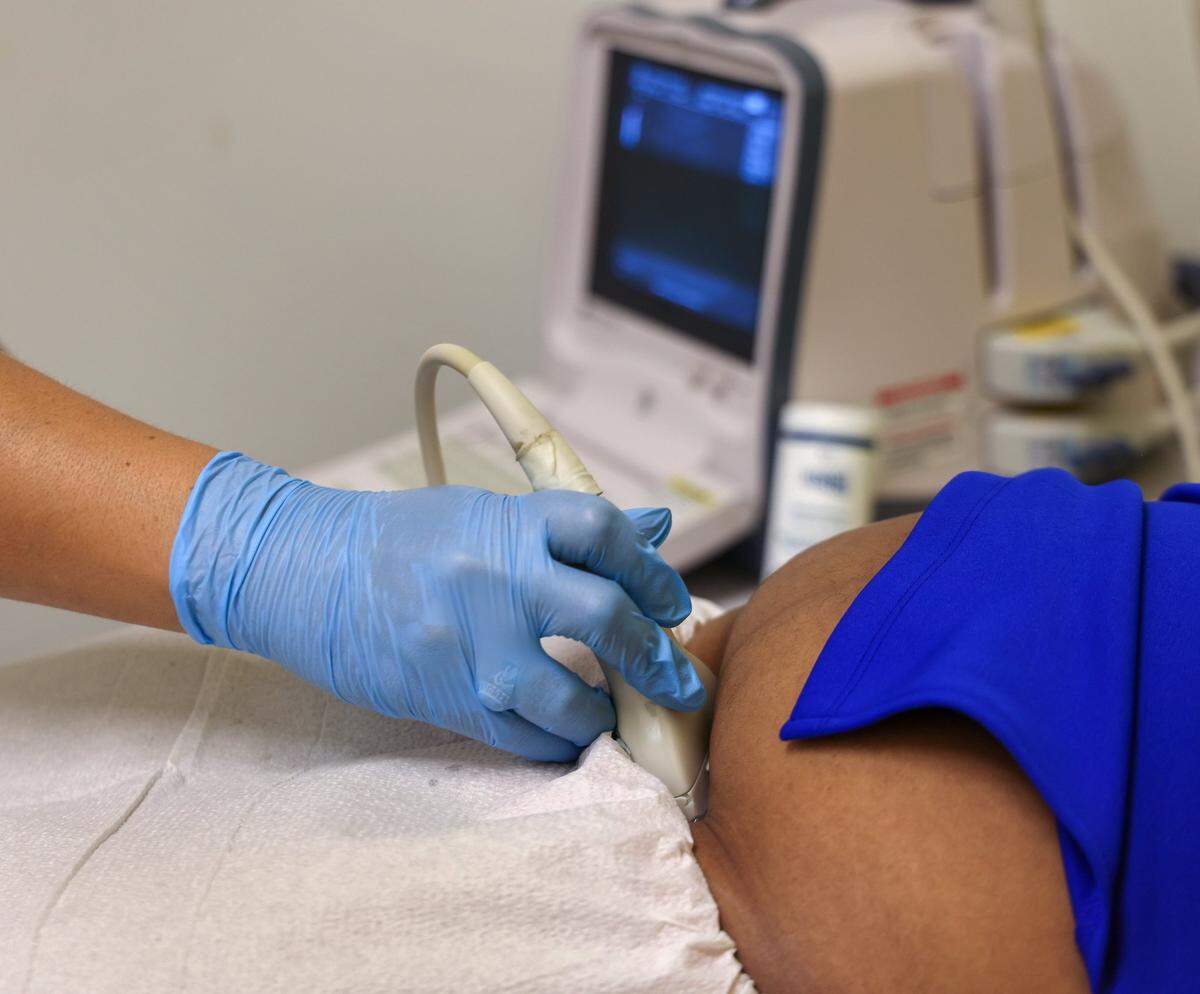 An unidentified patient gets ultrasound to acknowledge the gestational age of the fetus on Monday, April 24, 2023 at the East Cypress Women’s Center.