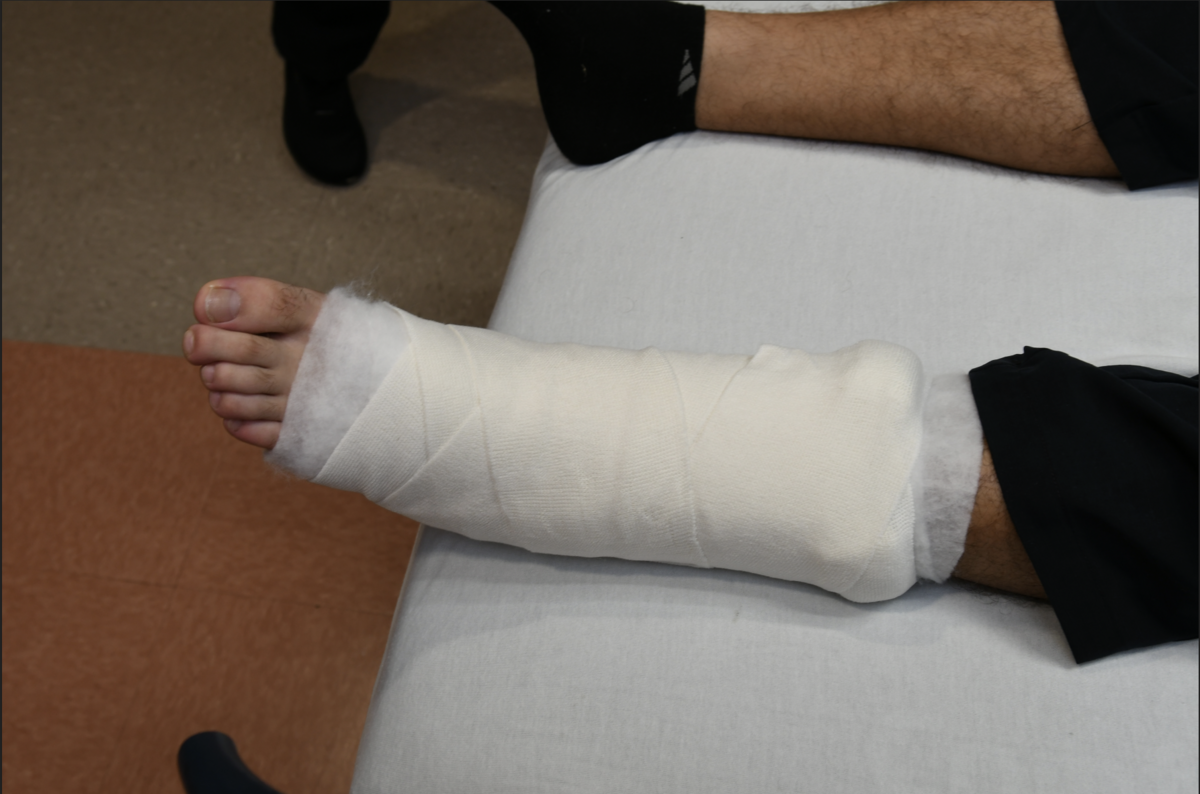 Pinecrest Officer Andres Garcia suffered a swollen foot after a side-by-side vehicle sped off from a gas station, making impact with his car just as he was stepping out.
