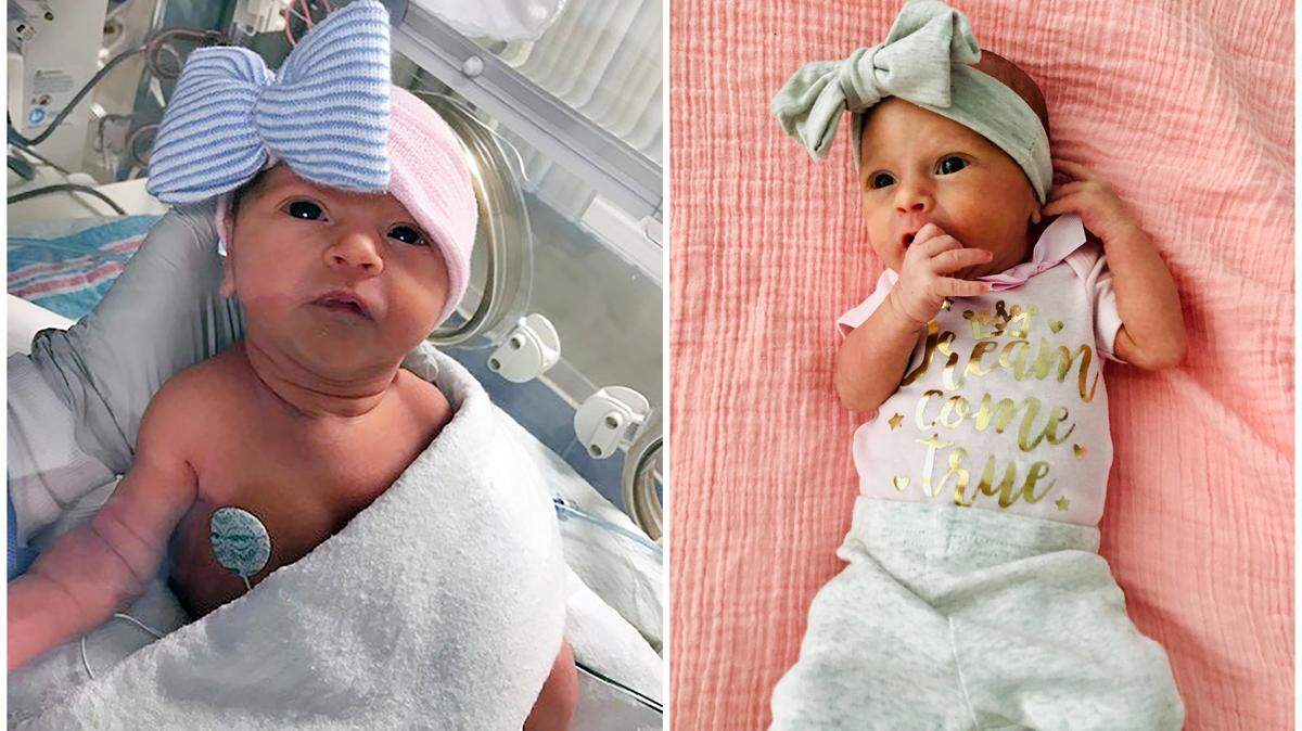 Giana Marie Verde, who was born at 34 weeks on April 2, 2020, at Baptist Hospital after her mother was diagnosed with COVID-19.