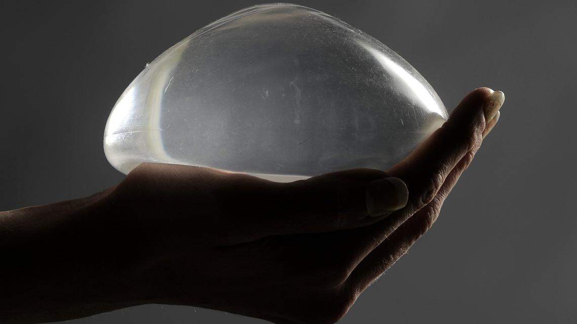 Breast implants can become hardened and elevated or depressed, which is caused by a capsular contraction. Surgery may be needed to replace the implant.