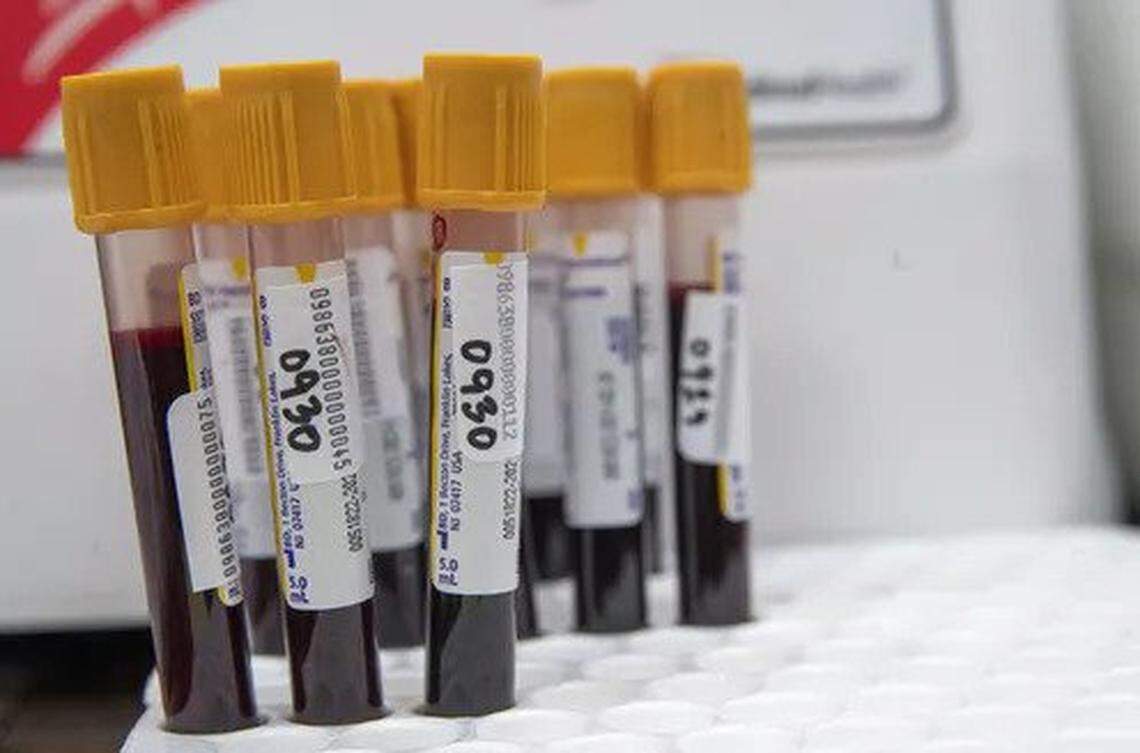 Florida needs blood and plasma donations as hospitals plasma therapy to boost antibodies in COVID-19 patients. 