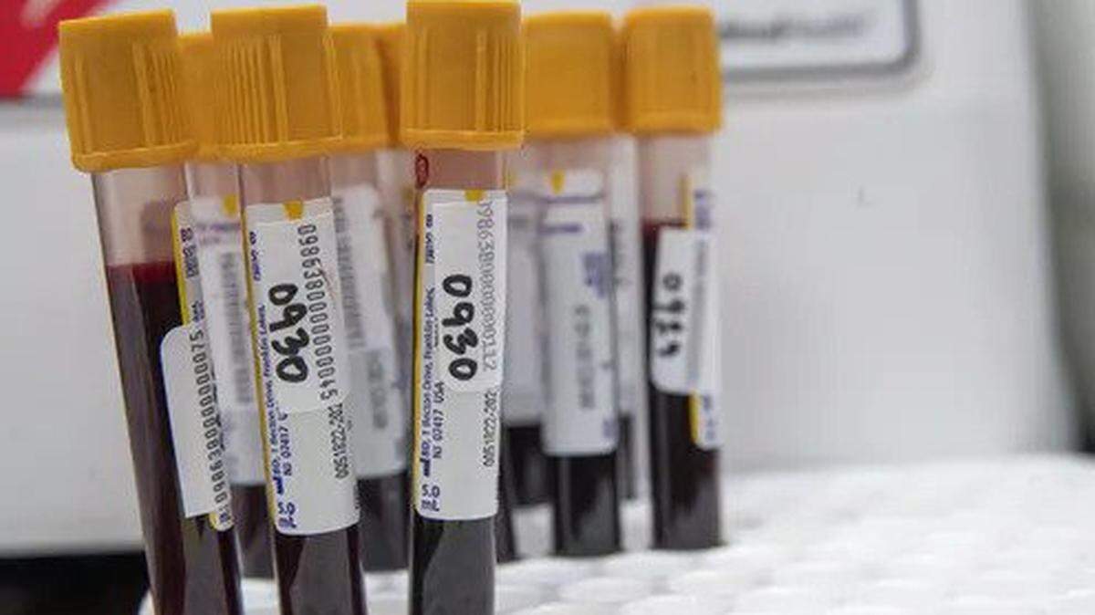 Florida needs blood and plasma donations as hospitals plasma therapy to boost antibodies in COVID-19 patients.