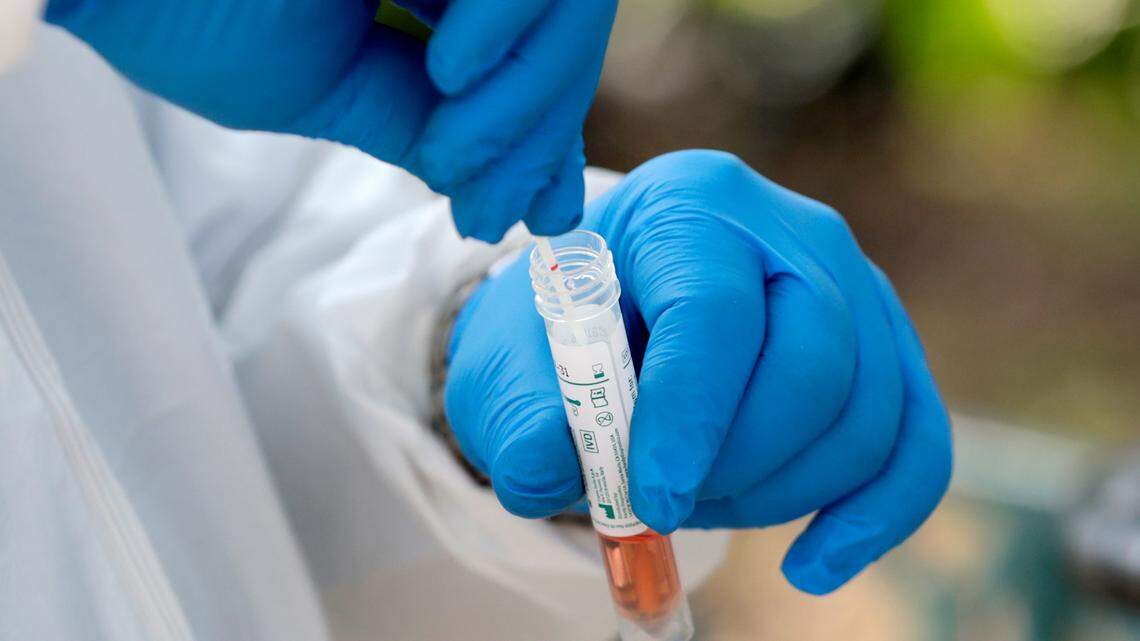 KY reports no counties at high COVID level as state prepares to scale back reporting