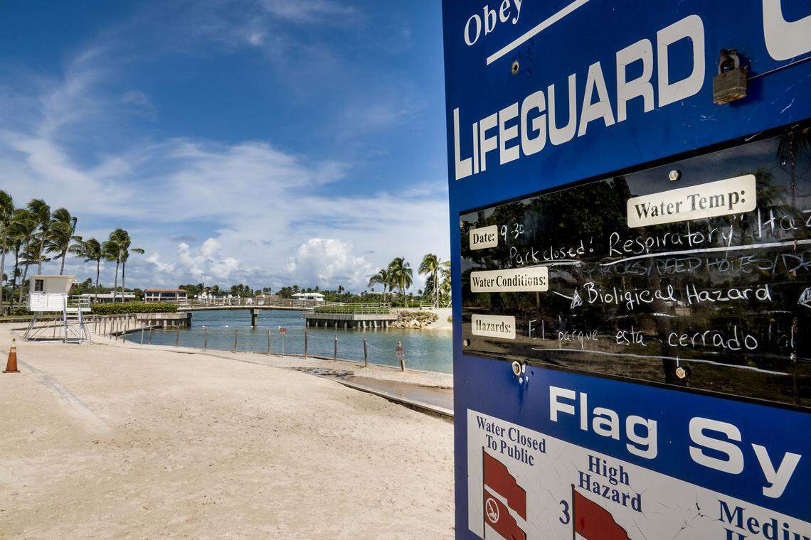 A lifeguard sign warns visitors of closed water due to biological and respiratory hazards at Dubois Park in Jupiter on Monday.  The state confirmed it was red tide.