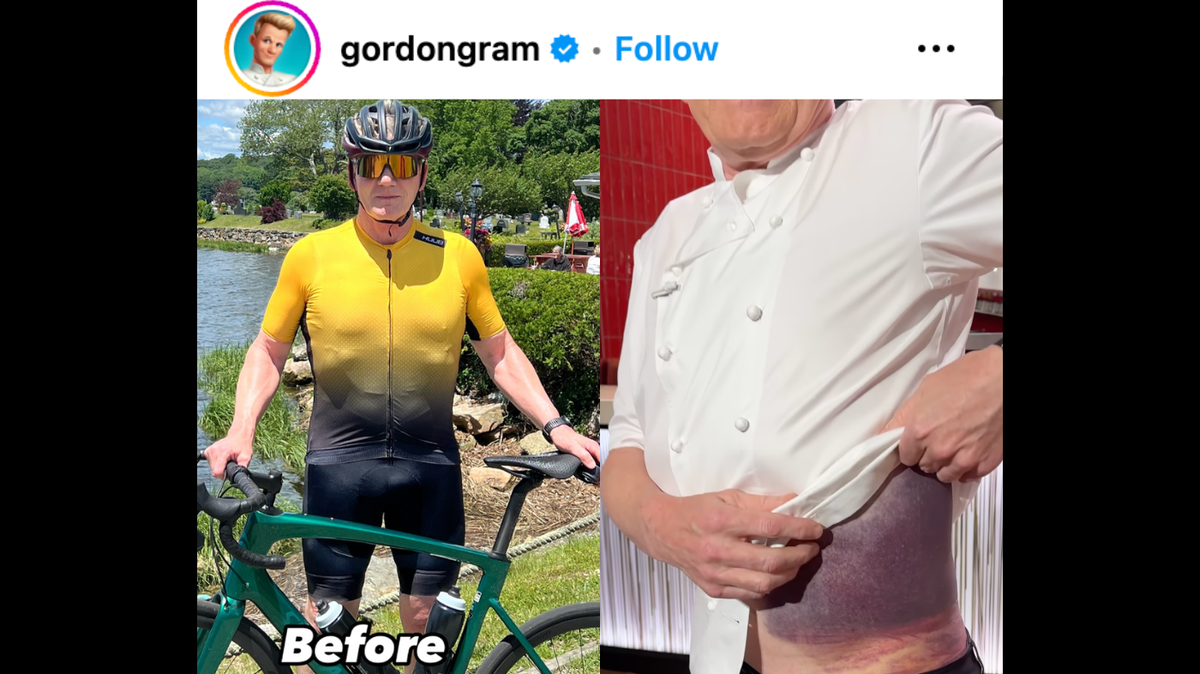 Chef Gordon Ramsay is revealing the horrific injury he suffered after getting into a bad bike accident.