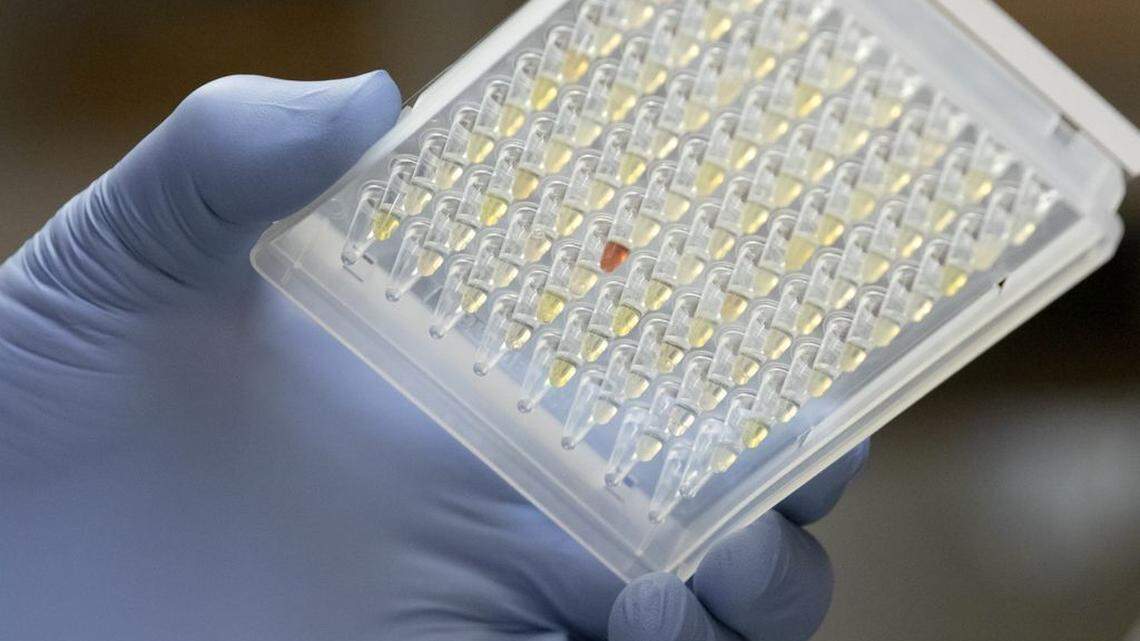 Daniel Streblow, Ph.D., holds a plate of plasma samples that contain COVID-19 antibodies. A new small study suggests that if you contract a COVID-19 breakthrough case, you may be gifted with “super immunity.”