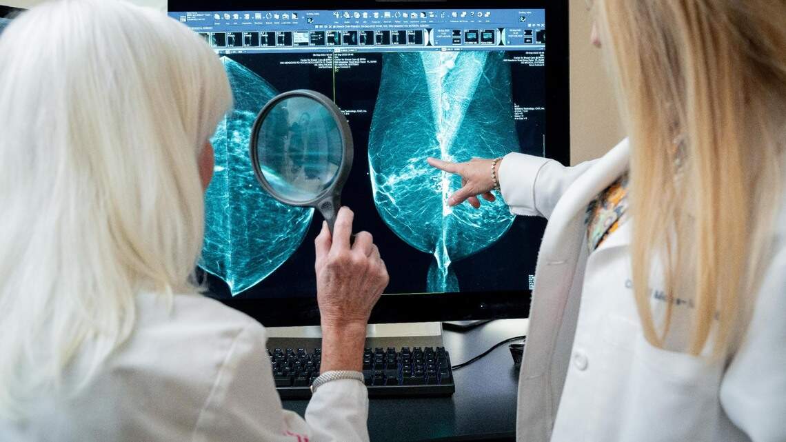 ‘New era and treatment of breast cancer’: AI is helping detect breast cancer earlier