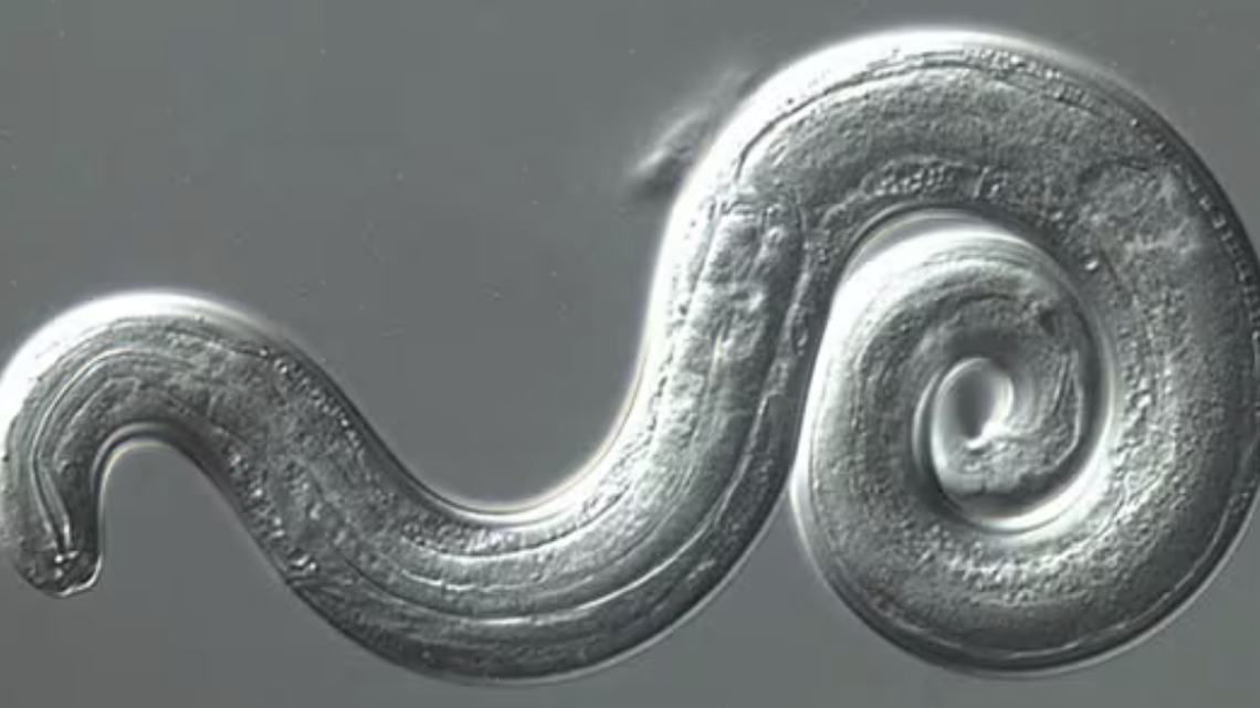 Angiostrongylus cantonensis, a parasitic roundworm, was found in a woman’s brain after a long trip to Thailand, Japan and Hawaii, according to a case report.
