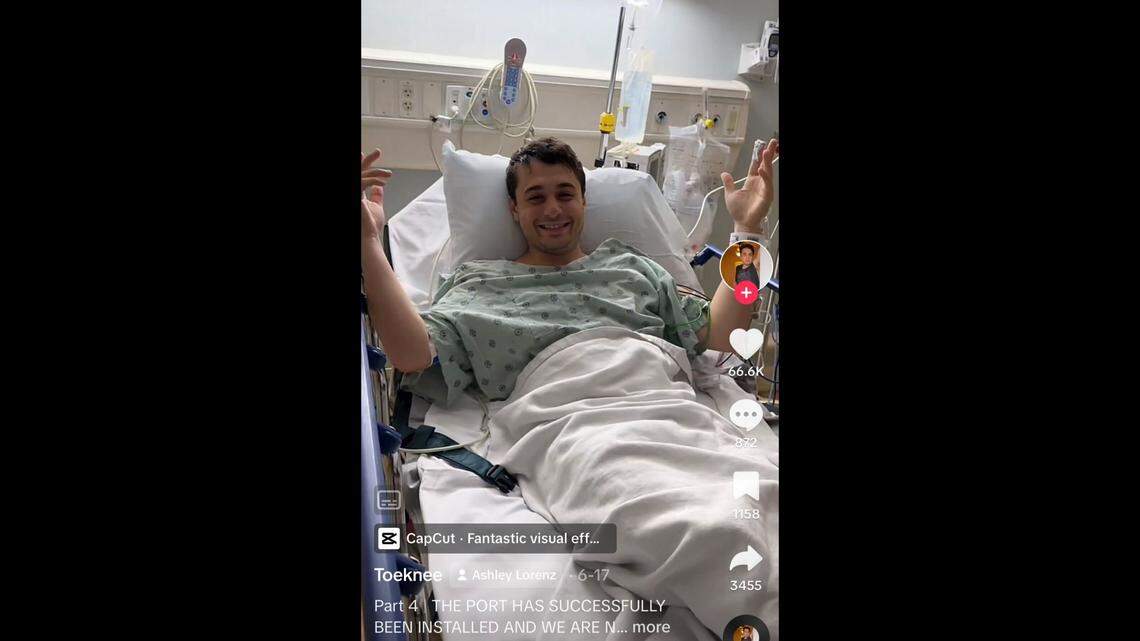 Anthony Corrado, 27, has taken to TikTok to document his cancer treatments.