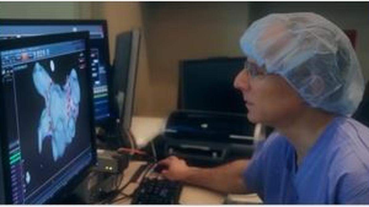 Dr. Jeffrey Goldberger, chief of the cardiovascular division at UHealth, co-developed an MRI that measures blood flow velocity and a heart mapping system to make treatments for AFib more precise.