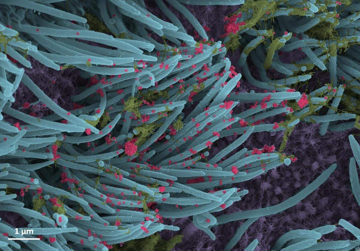 A higher power magnification image shows the structure and density of SARS-CoV-2 virions (red) produced by human airway epithelia.