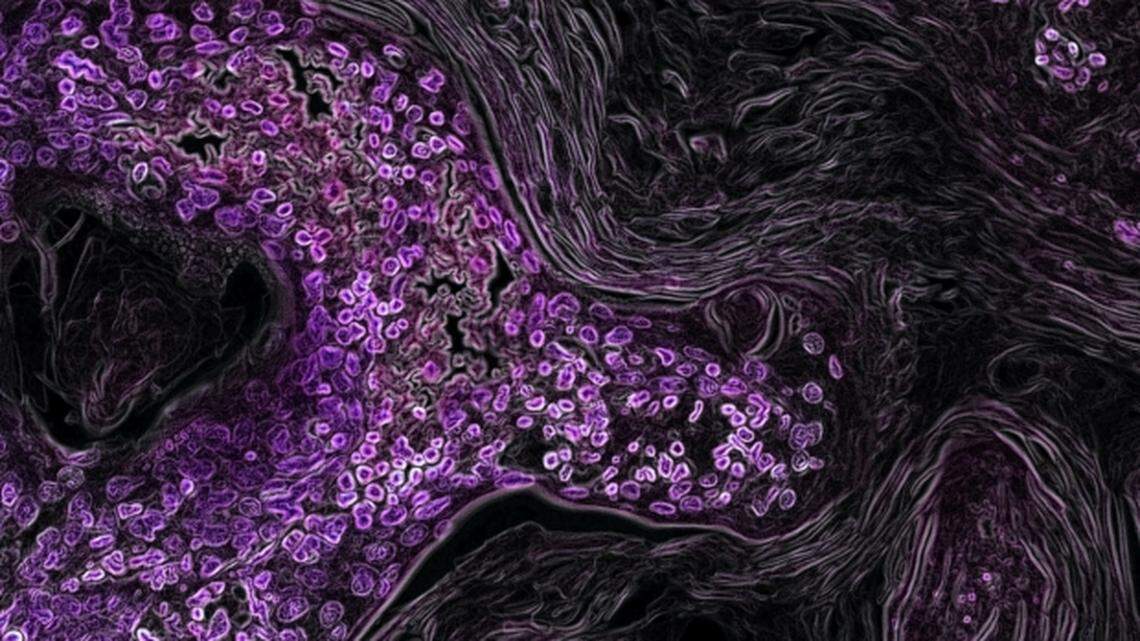 A review of more than 600,000 patient records by Stanford School of Medicine researchers found that people are delaying medical care until they turn 65 years old, despite the risks involved, which is when they become eligible for Medicare.