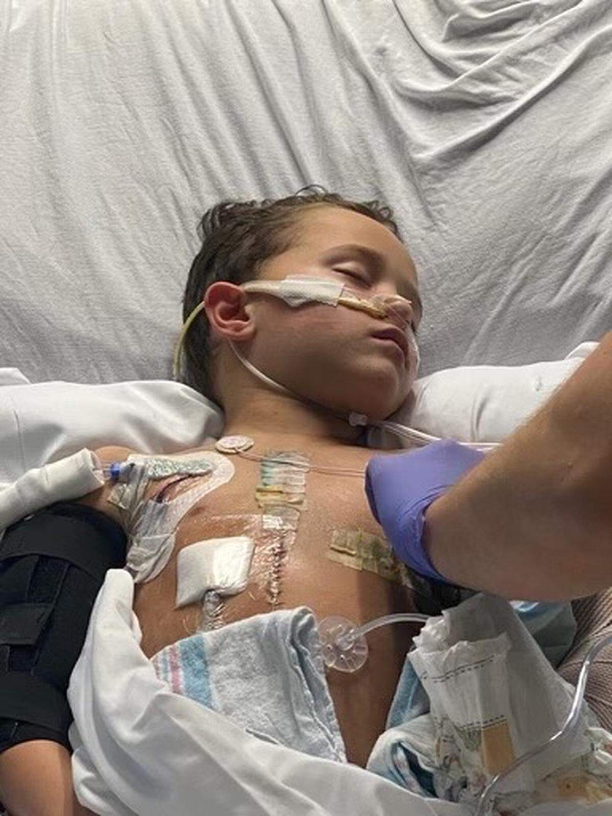 Jacob Estrada, 7, remained in the intensive care unit of Joe DiMaggio Children’s Hospital 52 days after the crash.