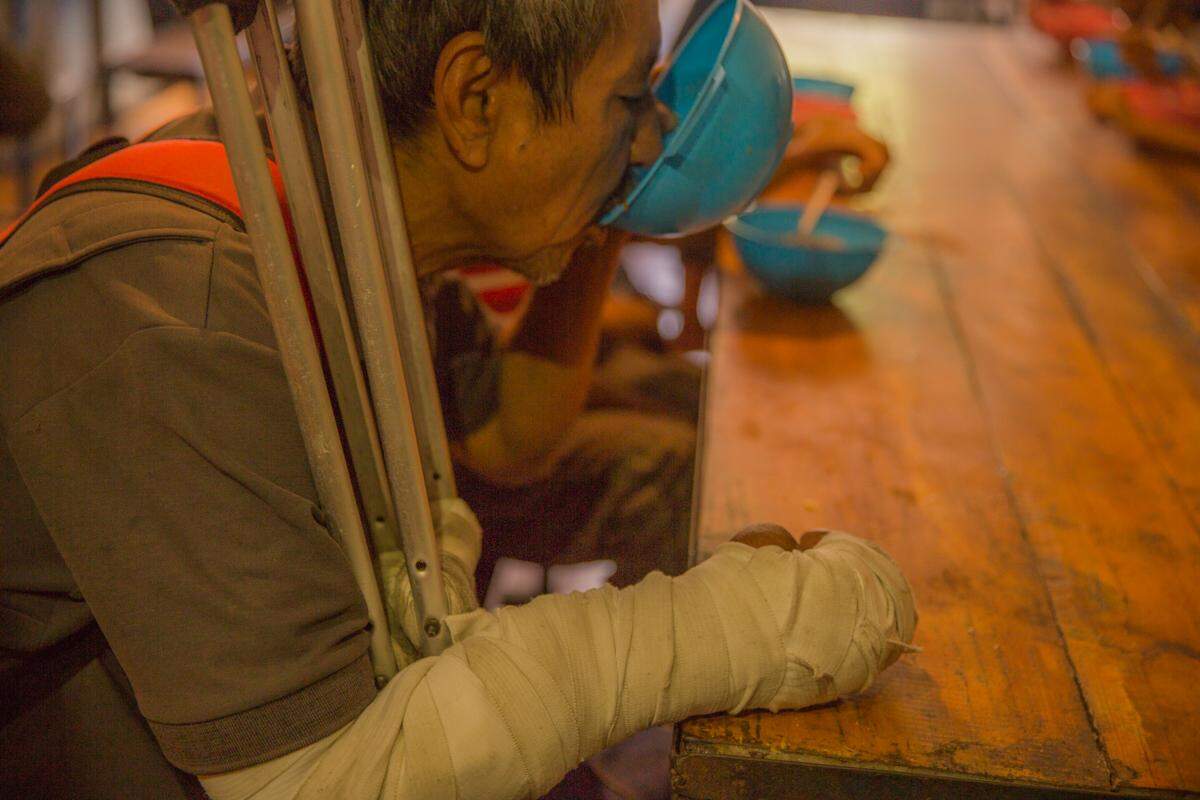 Luis Alfredo Sandoval, 52, was run over by a car and left in the street. He lives in the plaza across from Casa de Maria in the Propatria area of Caracas and comes by every day for a meal.