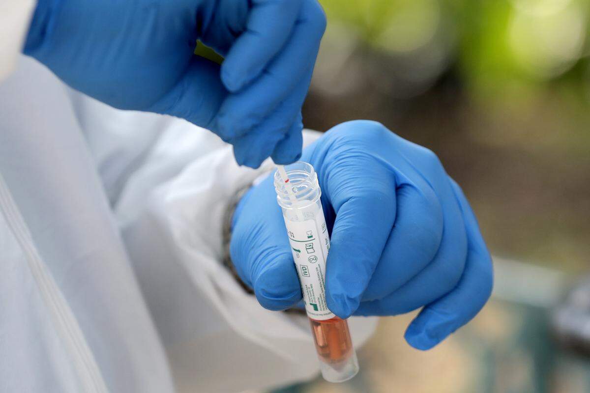FILE - In this April 16, 2020, file photo, a medical worker places a swab in a vial while testing the homeless for COVID-19 through the Miami-Dade County Homeless Trust, during the new coronavirus pandemic, in Miami. An Associated Press analysis finds that most states are not meeting the minimum levels of testing suggested by the federal government and recommended by public health researchers even as many of them begin to reopen their shattered economies. (AP Photo/Lynne Sladky, File)
