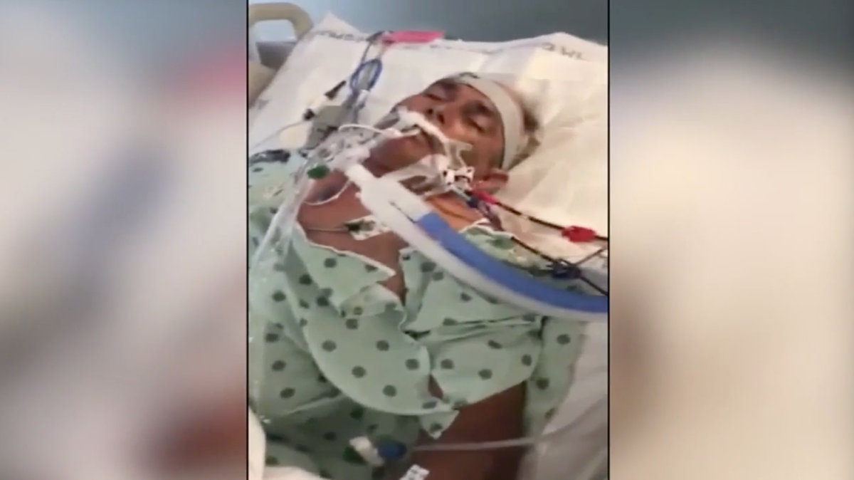 Angel Perez went crabbing in the Maurice River in New Jersey and his right leg began to swell hours after the trip, family says. Doctors say he has Vibrio, a flesh-eating bacteria, and that all four of his limbs are discolored and at risk.