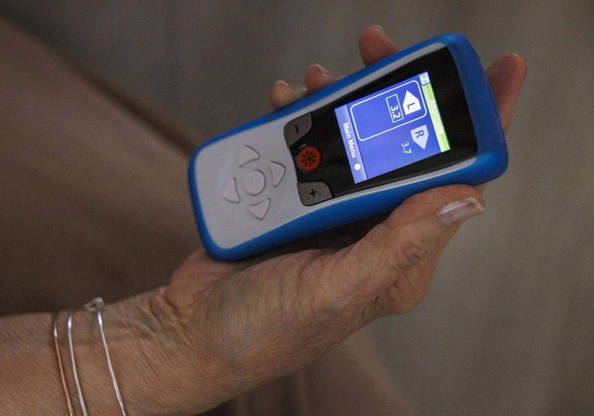 Ivonne Gonzalez holds her DBS, deep brain stimulation, device that they say changes the intensity of the electric current thatÕs running through the brain inside her home on Tuesday, April 28, 2026, in Miami, Fla.