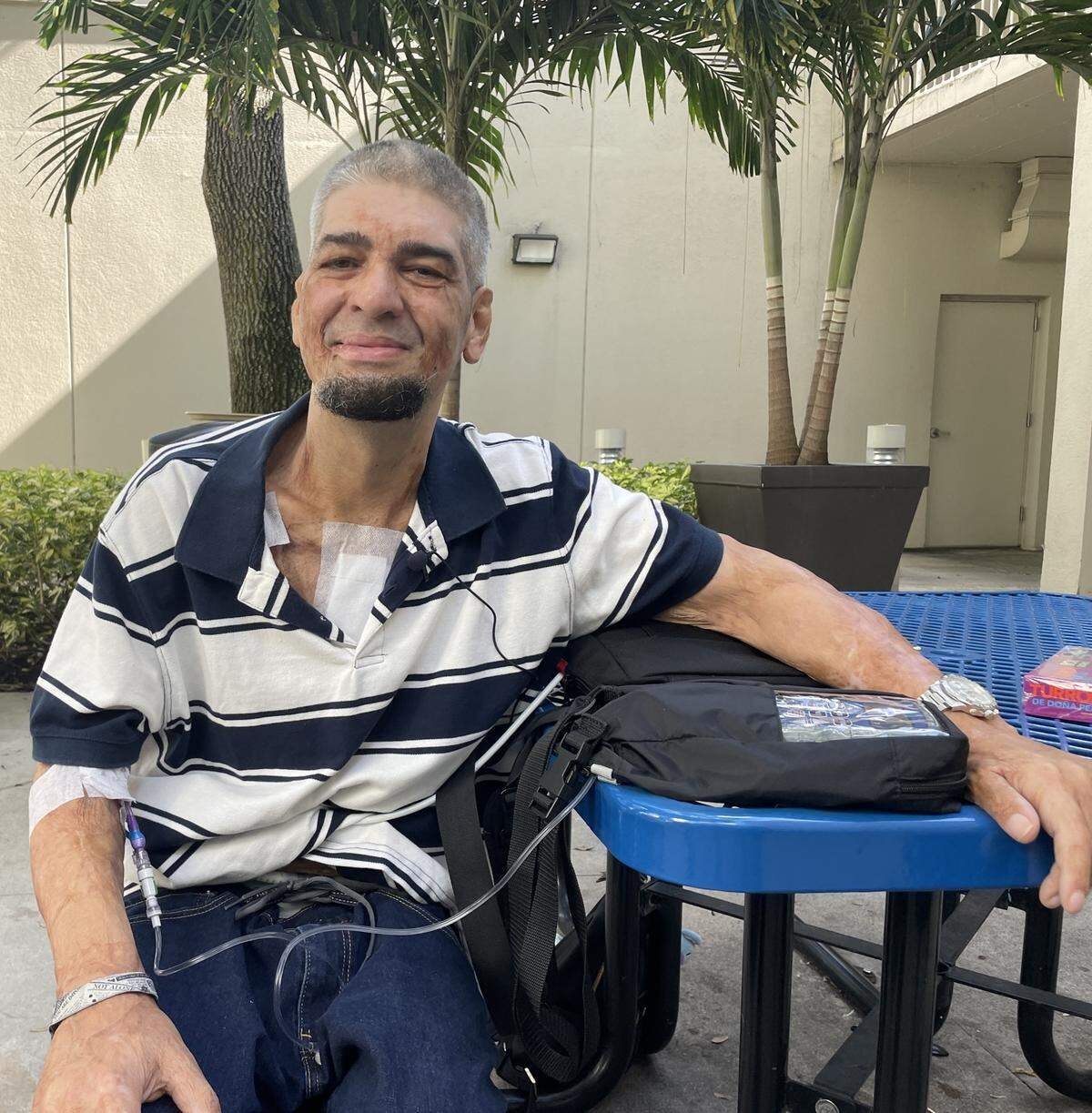 As a child, Alberto Reyes was burned over 70% of the body. At 37, he has heart problems. He’s shown here at Memorial Regional Hospital, which nominated him for help from Wish Book.