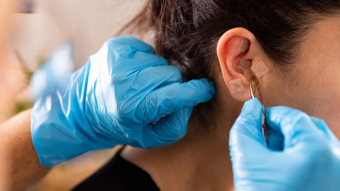 The Tiny Gold Beads People Are Pressing Into Their Ears and What Experts Say About Them