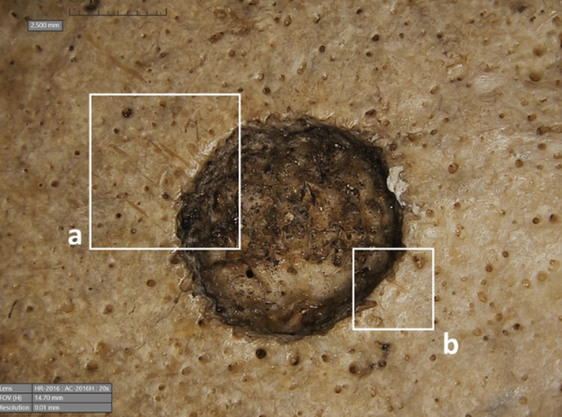 Small cuts around the lesion marks were made by tools, researchers said.