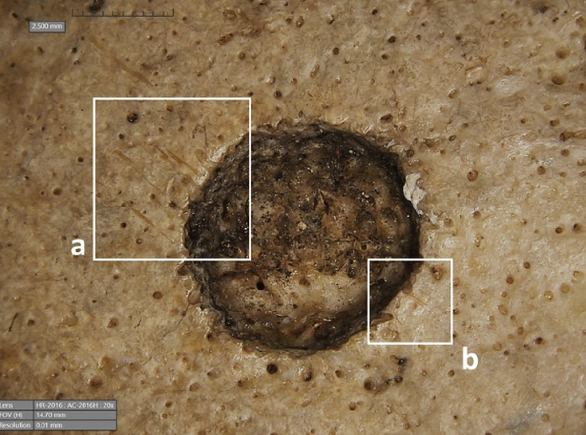 Small cuts around the lesion marks were made by tools, researchers said.