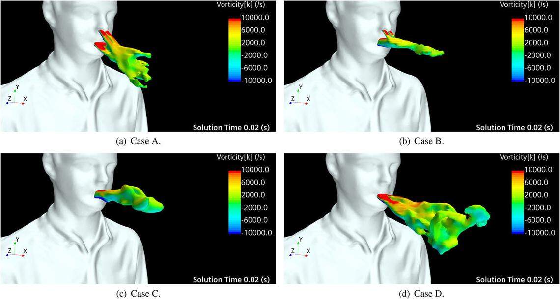 (a) open nasal passage with teeth, (b) open nasal passage without teeth, (c) blocked nasal passage without teeth, and (d) blocked nasal passage with teeth.