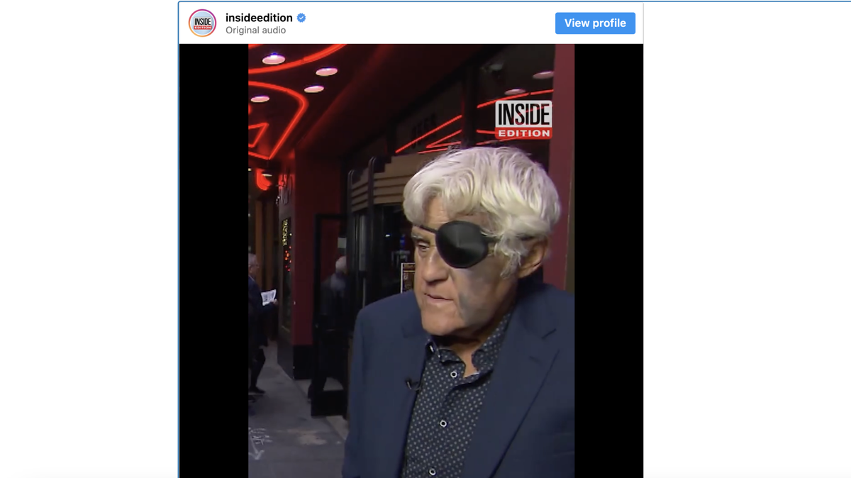 Jay Leno reveals a face full of bruises following fall.