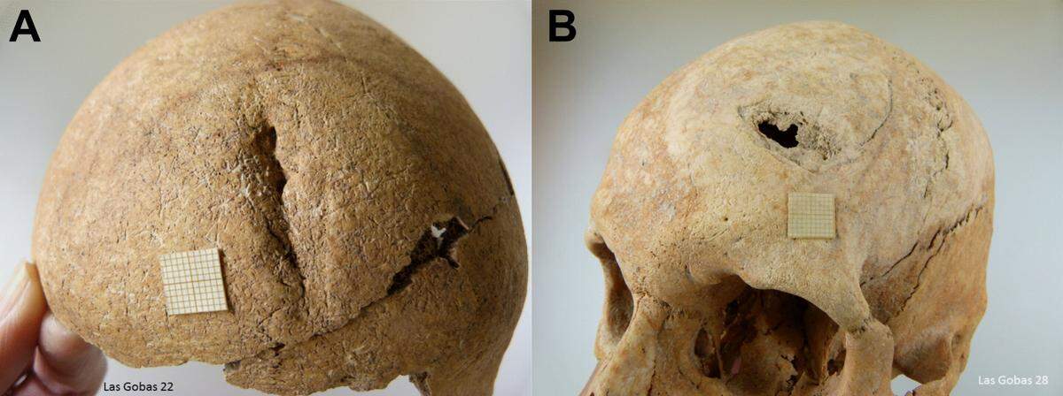 Two skulls of relatives showed significant, and deadly, injuries from swords, researchers said.