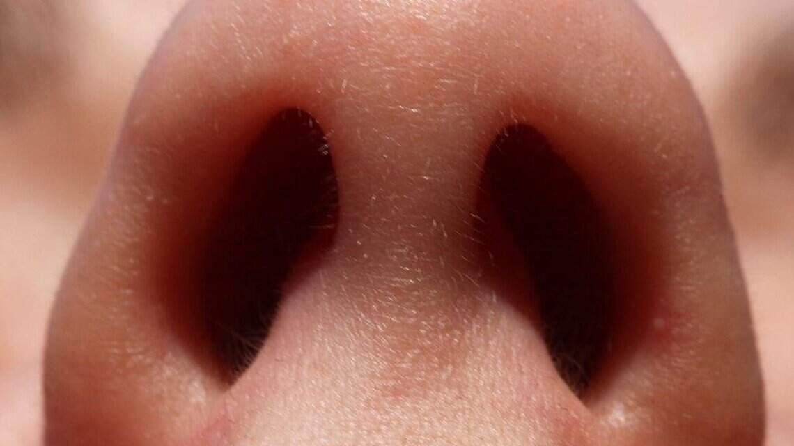 I had a nose job and my new nose seems strange. Is this common? | Opinion