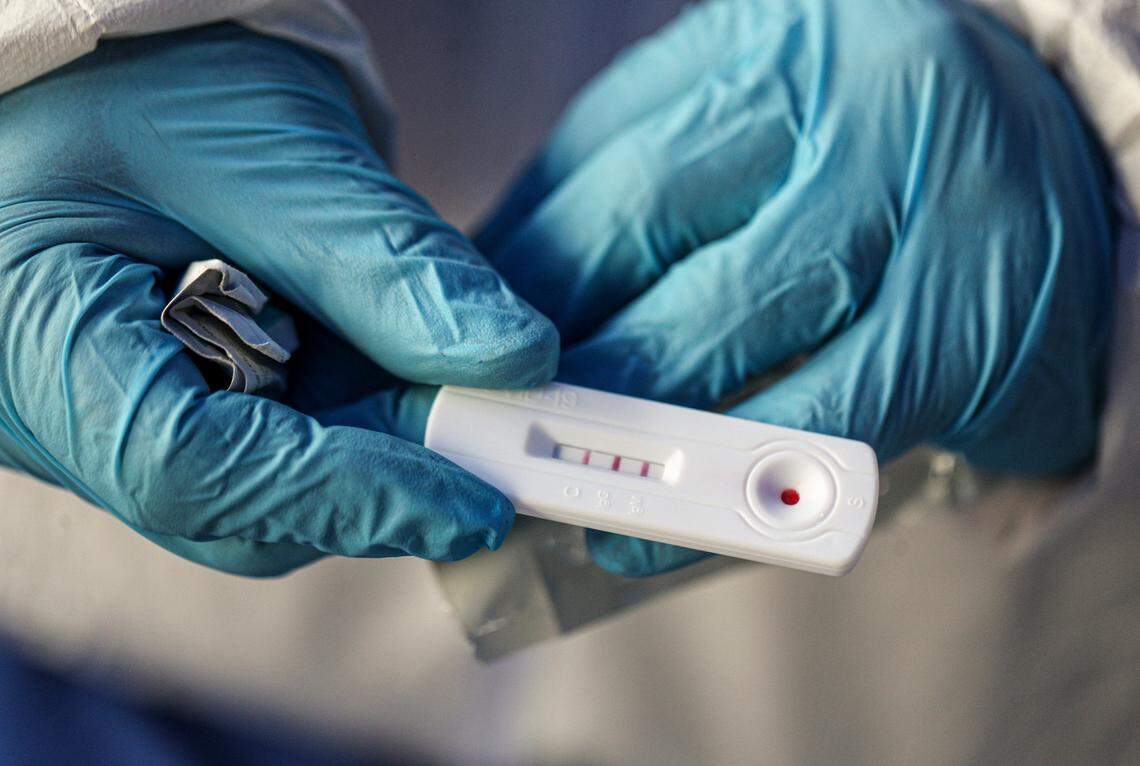 Healthcare worker Patricio Candia shows a rapid COVID-19 test with a positive result outside a supermarket in Santiago, Chile, Saturday, June 27, 2020.