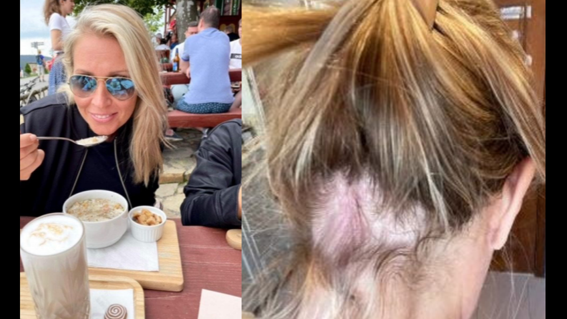 This photo shows another example of apparent damage caused by Olaplex products.