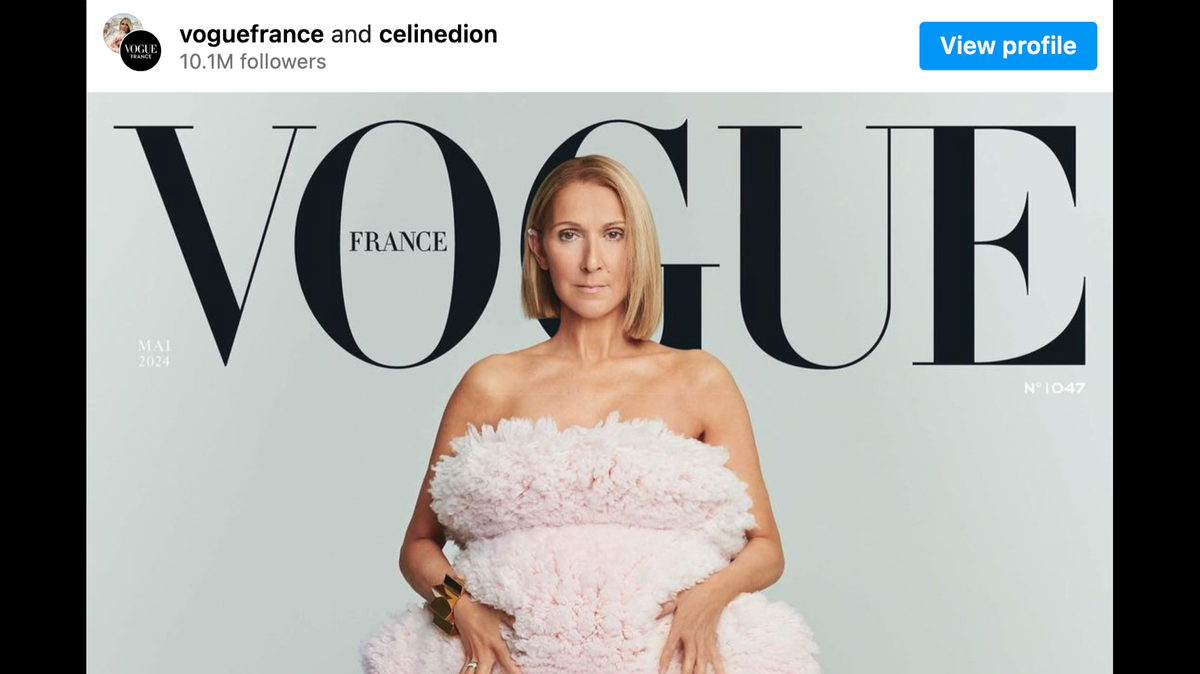 Celine Dion is opening up about what her day-to-day looks like as she continues to live with Stiff Person Syndrome and if she will ever return to the stage.