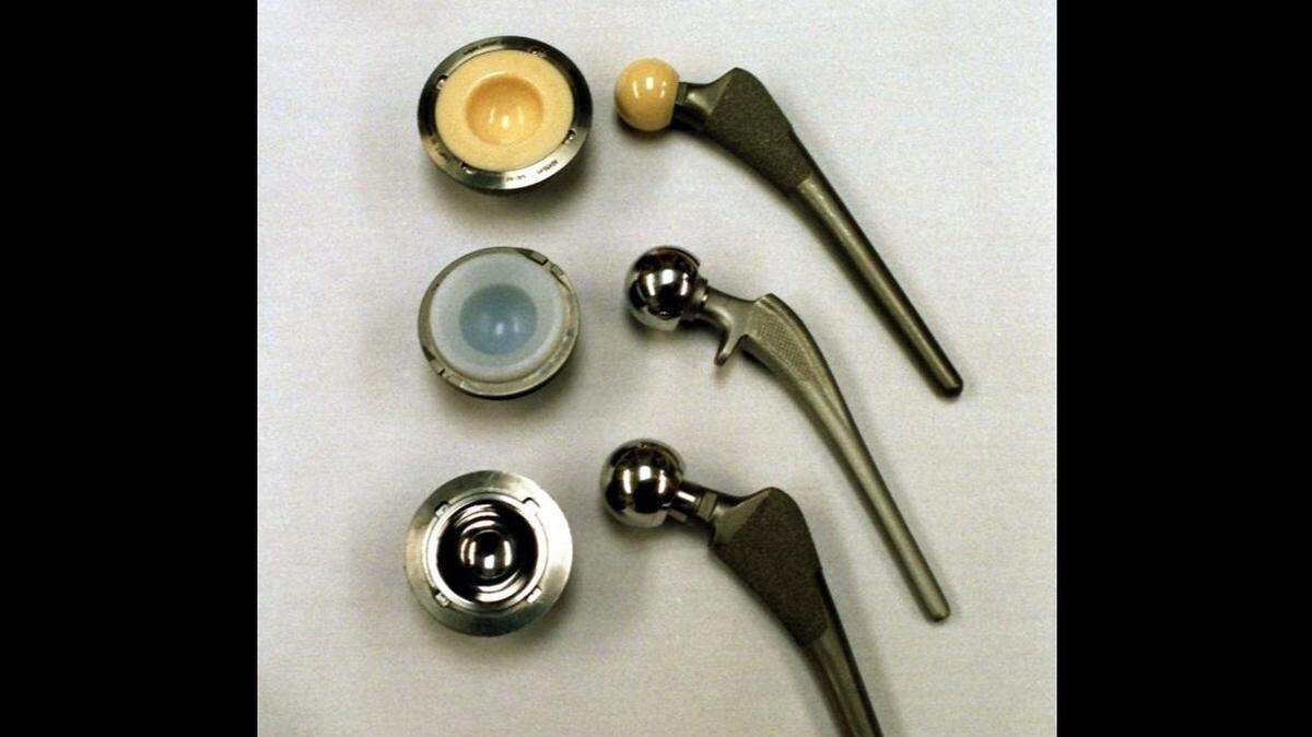 Advances in hip implants have made hip-replacement surgery much easier, with patients walking with a walker the day after surgery. From top are implants using ceramics, plastic and metal.