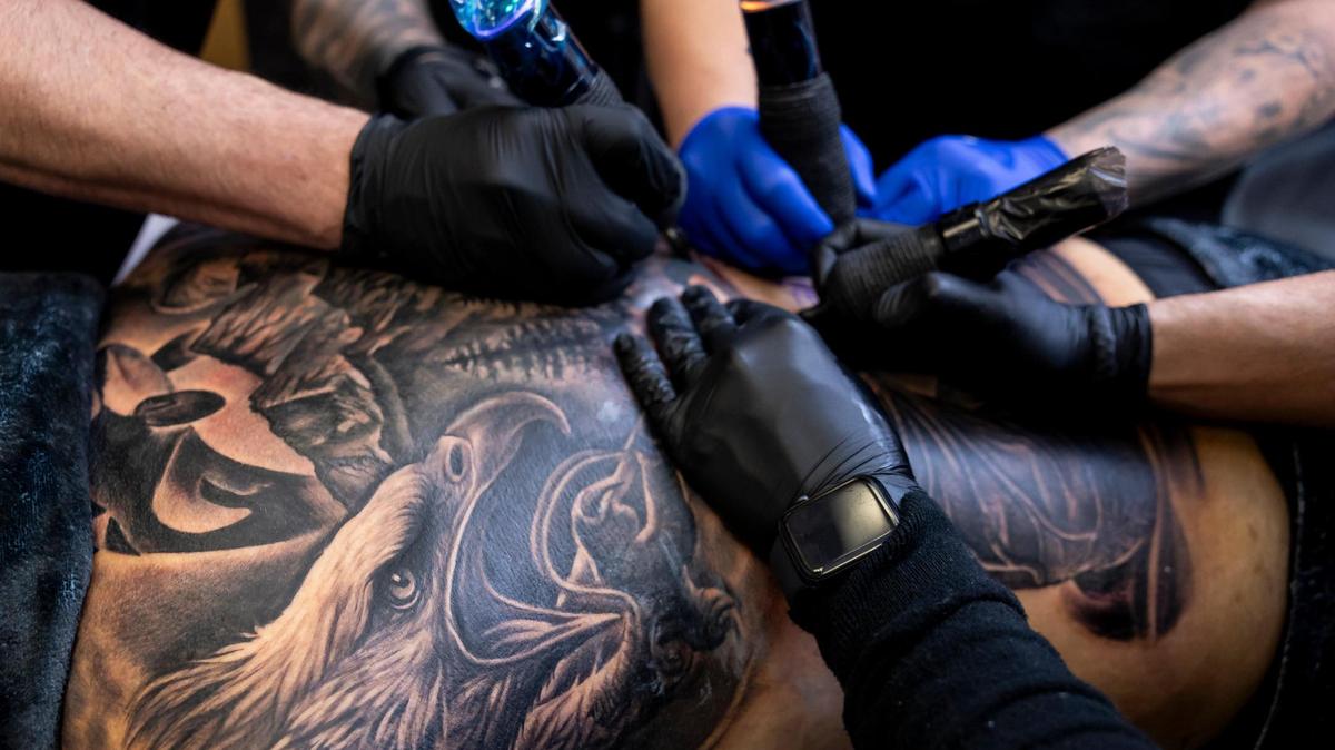 Sedation Ink artists work on a back tattoo for client Dom Groenveld as he is anesthetized at a surgical office on Monday, Jan. 20, 2025, in Miami, Fla. Sedation Ink offers tattooing under anesthesia, allowing clients to complete extensive body art in a single session.