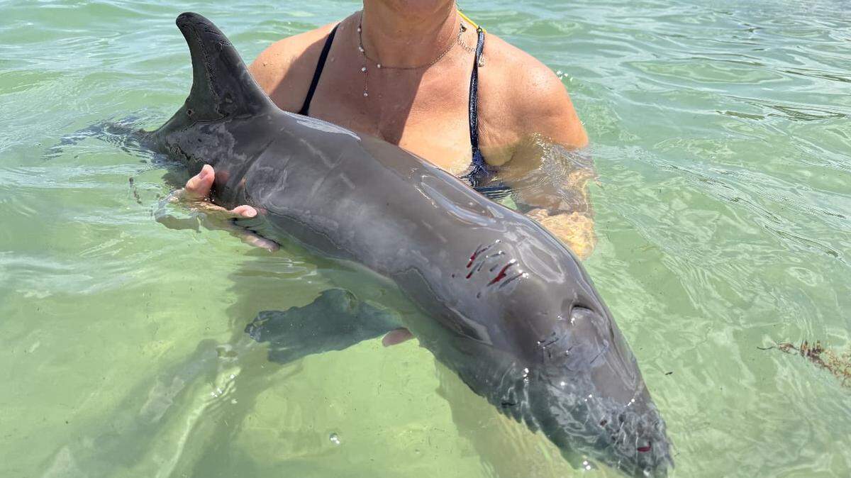 A lifeguard rescued a beached and injured baby dolphin at Haulover Beach on Saturday, according to Miami-Dade Fire Rescue.