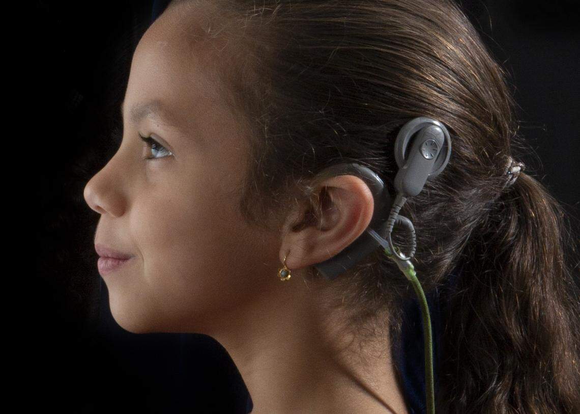 Marcia Guillou, 6, wears a bilateral cochlear implant that allows her to hear.